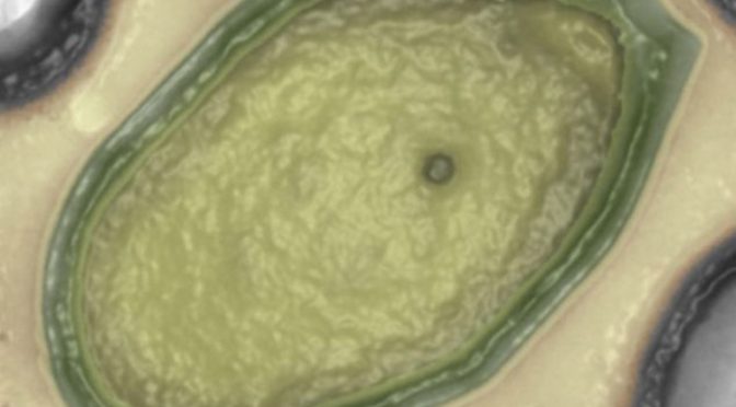 PandoraVirus: Giant Virus Discovered