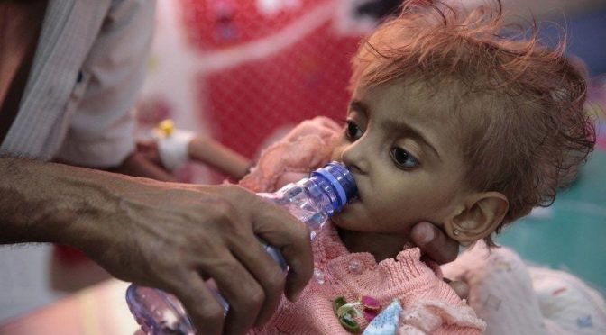 United States and France Jointly Responsible for Famine in Yemen
