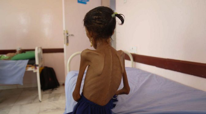 Saudi Attacks on Yemen’s Farmers are Pushing the Whole Country into Famine